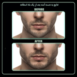 دستگاه زاویه ساز فک رادیس فیت مدل Strong Weight بسته 2 عددی