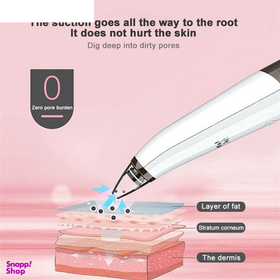 میکرودرم خانگی گلویش استایل مدل MP503