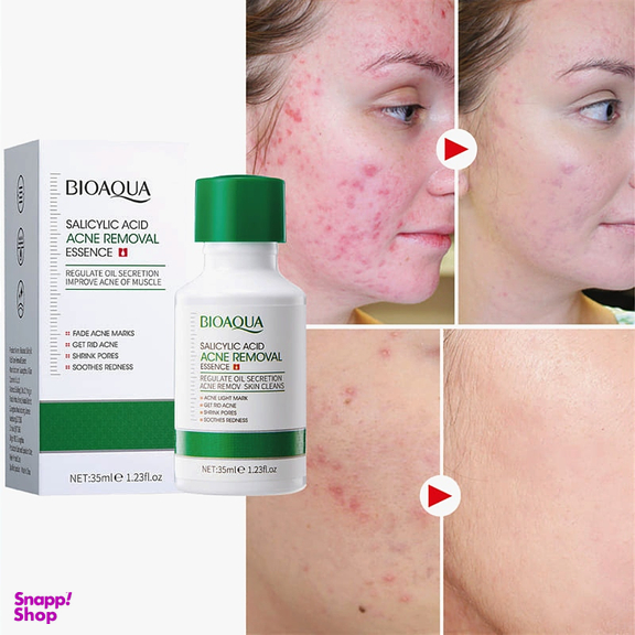 سرم ضد جوش بایو آکوا مدل salicylic acid حجم 35 میلی لیتر