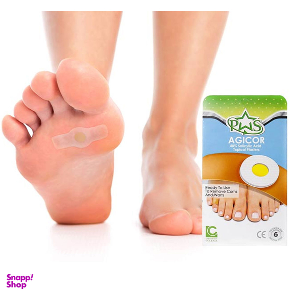 چسب موضعی میخچه و زگیل آجیکور