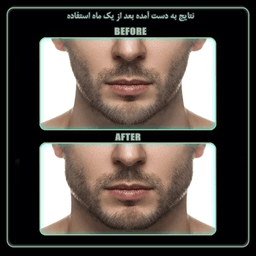 دستگاه زاویه ساز فک رادیس فیت مدل Medium Weight بسته 2 عددی