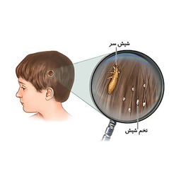 پودر شپش کش هلاک مدل Louse Killer وزن 100 گرم