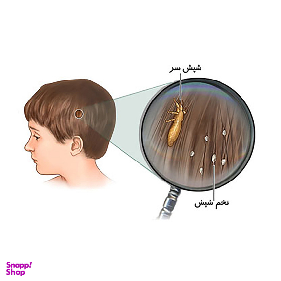 پودر شپش کش هلاک مدل Louse Killer وزن 100 گرم