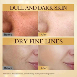 کرم ضد چروک سادور مدل زهر زنبور وزن 50 گرم