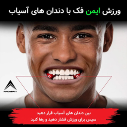 دستگاه زاویه ساز فک رادیس فیت مدل Light Weight بسته 2 عددی