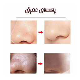 میکرودرم گلویش استایل (Golwish Style) مدل MT-84