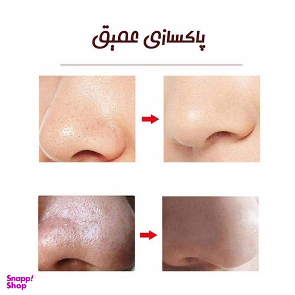 میکرودرم گلویش استایل (Golwish Style) مدل MT-84