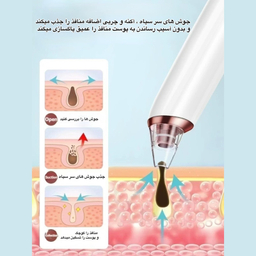 میکرودرم مدل KNY_E27
