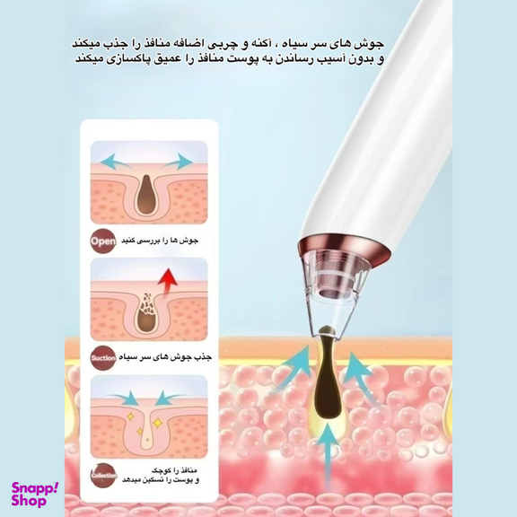 میکرودرم مدل KNY_E27