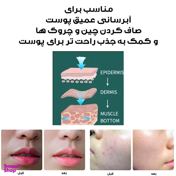دستگاه آبرسان پوست کد ZM150