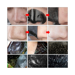 ماسک بینی لانبنا مدل Ni وزن 5 گرم بسته 10 عددی