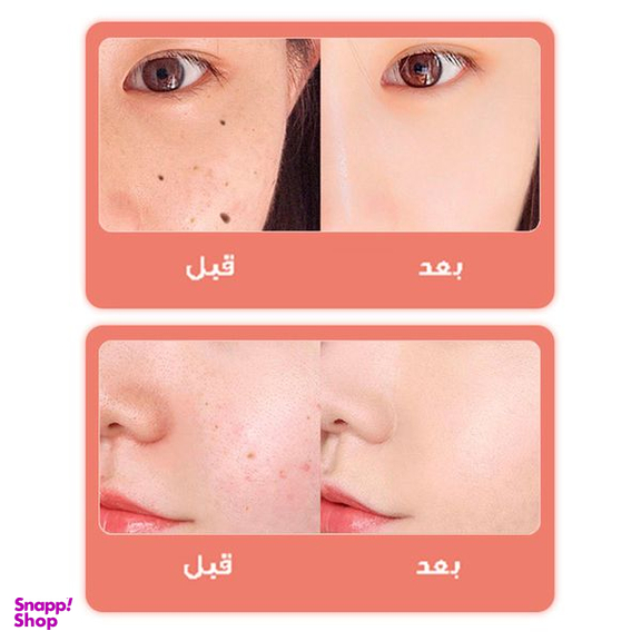 قلم پاک سازی پوست مدل دیجیتالی کد 9 سطح