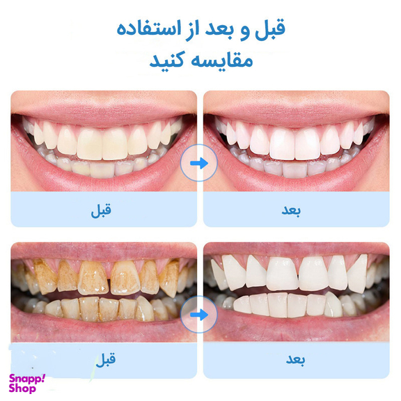 دستگاه شست و شو و جرم گیر دندان برقی مدل IPX7